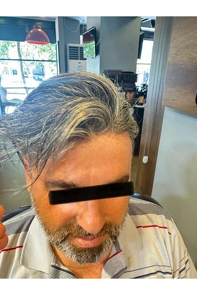 İNTERPROTEZ Prosthetic Hair New Austria - 6X9 - Color Grey Fine Wire All Directional Weave Substructure 100% Human Hair