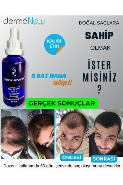 dermanew hair Saç gürleştirici serum , losyon , serum , saç uzatıcı yağ / 5 Adet Serum