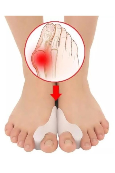 sanal trend Bay Parmak Arası Ayak Bunyon Kemik Koruyucu Silikon Makaralı Ayak...