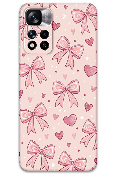 Gramaphone Xiaomi Redmi Note 11 Pro Plus 5G Uyumlu Kurdele Desenli Telefon Kı...