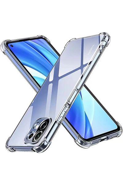 Choice جراب شفاف بسمك 1.5 مم مع وسادة هوائية لهاتف Xiaomi 11 Lite NE 5G لهاتف Xiaomi Mi 11 Lite 12S 12X 11T 12T 13 1