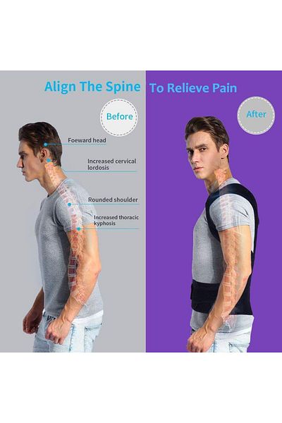 ALEXANDER HUD Women Men Erect Posture Corset Kyphosis Anti-Hunchback Back Corset for Standing Walking Sitting