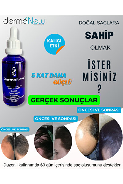dermanew hair Sac Bakimi Sac Serum Ve Yagi - Sac Bakım Yağı - Saç Cıkartıcı Serum - 3 Adet Serum Roller Şampuan