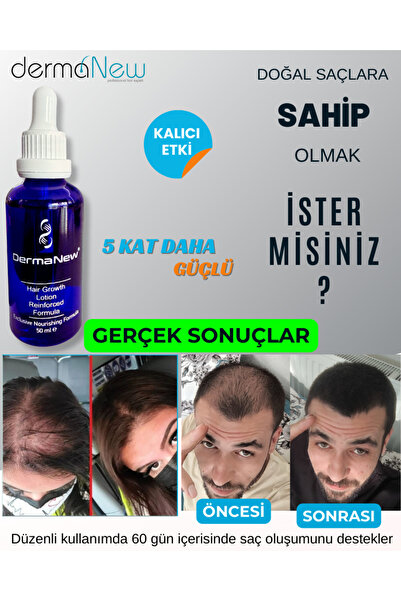 dermanew hair Sac Bakim Seti Sac Serumu Yagi - Sac - Saç Çıkartıcı Serum - Serum / 2 Adet