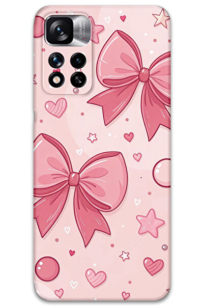 Gramaphone Xiaomi Redmi Note 11 Pro Plus 5G Uyumlu Kurdele Desenli Telefon Kı...