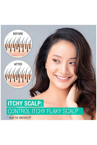 Neutrogena Scalp Therapy Anti-Dandruff İtchy Scalp Şampuan 354 ML