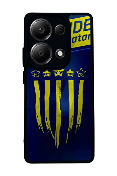 BGAKSESUAR Xiaomi Redmi Note 13 Pro 4G Uyumlu Mat Siyah Kılıf – Yumuşak Silik...