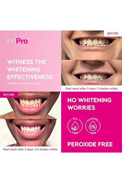 genernic InoPro Teeth Whitening Strips 14 Treatments - Peroxide Free - 28 Strips