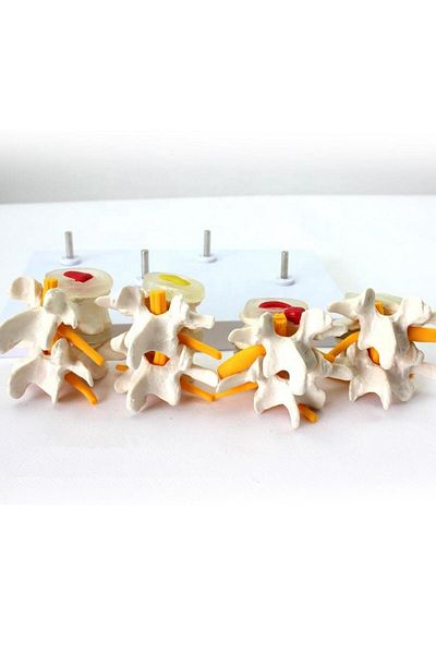 MAXİ Four Stage Hernia Model 3