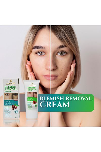 ALVANSO Blemish removal cream, lightening and sun protection