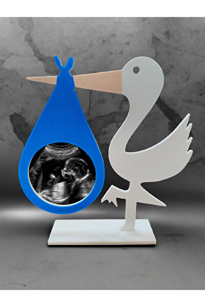 multiogz Ultrasound Frame & Leave a Beautiful Souvenir to Your Baby