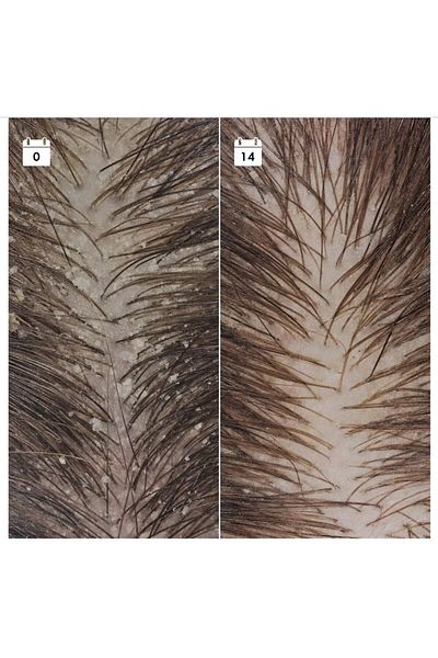 SEPHORA COLLECTION Anti-Dandruff Anti-Recurrence Serum - Hair Serum 30 ml