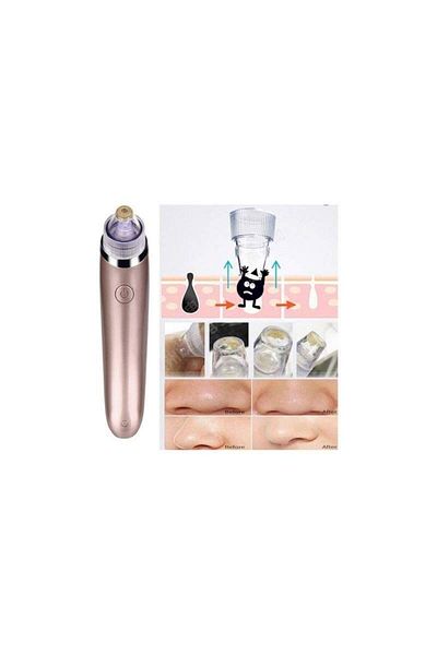 SIKS ® vacuum device for skin cleansing, against blackheads, portable, pink color