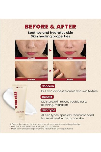 Secret Seoul 1988 Snail & Rice Moisturizing Cream (100ml)