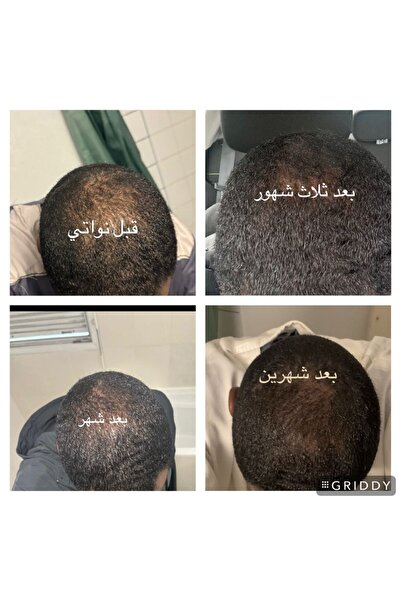 nawaty زيت الشعر الأصلي والعضوي من نواتي - تمر عجوة ونوى معتقة مع مزيج من الزيوت الطبيعية