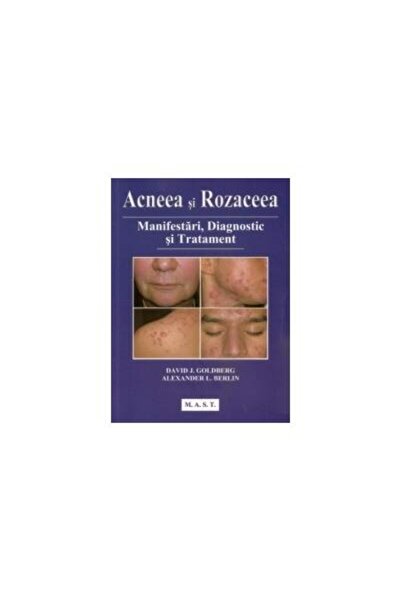 Editura Mast Acneea si Rozaceea. Manifestari, diagnostic si tra