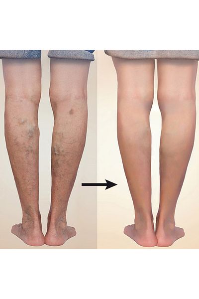zenifique Set of 2 Zenifique Compression Socks with High Compression Degree 23-32 Mmhg, Beige, Size L