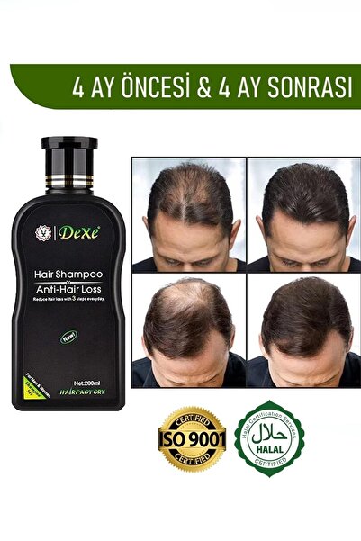 Dexe Anti Black Hair Şampuan 200 ml - Saç Dökülmesine Karşı Etkili