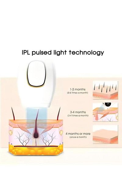 Generic جهاز إزالة الشعر بالليزر العالمي بدون ألم لكامل الجسم والفم والإبطين والساقين والذراعين والوجه، سلكي بالليزر