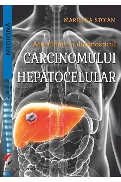 Editura Universitara Actualitati in diagnosticul carcinomului hepatocel