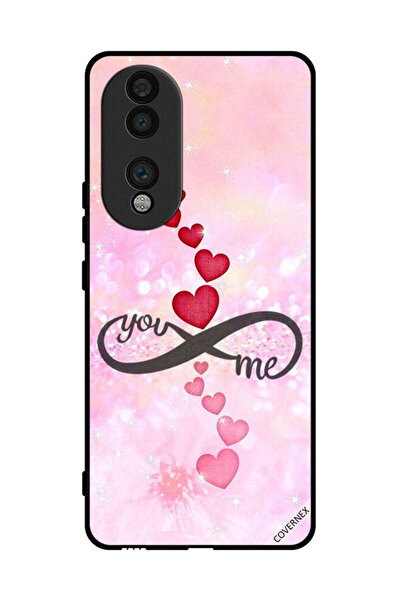 Covernex غطاء حماية لهاتف Honor 70 You And Me