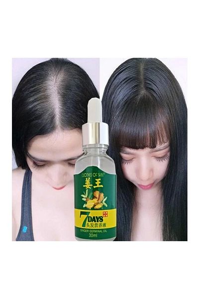 Enseb 7Days 30ml Gingergerminalessentialoil Hair Growth Loss Treatment Serum Unisex 3 Pieces Hair Care Oil