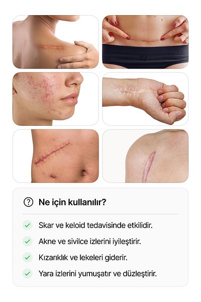 luofucon 35X25Cm Silicone Gel Scars Remover Tape for Surgery - Lesion Scar Keloid Skin Stretch Marks