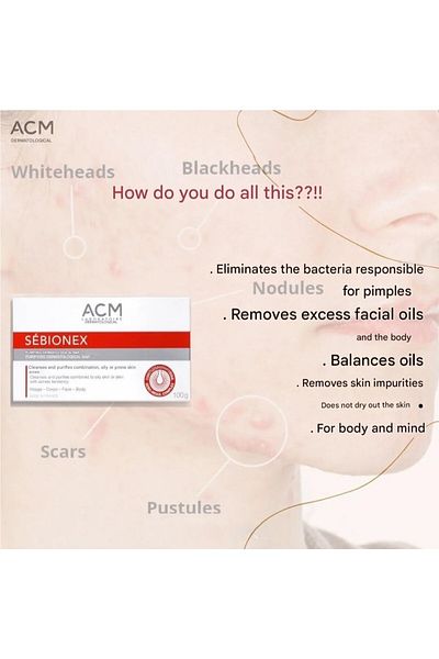 ACM Sebionex Purifying Bar 100g –soap-free Daily Cleanser For Oily & Acne-prone Skin, Gentle & Effective