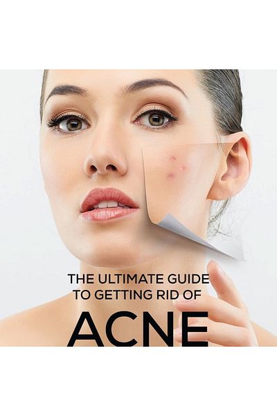 ACM Laboratoire dermatologique SEBIONEX Purifying dermatological bar 100g