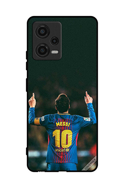 Covernex غطاء حماية لهاتف شاومي بوكو X5 الملك ميسي