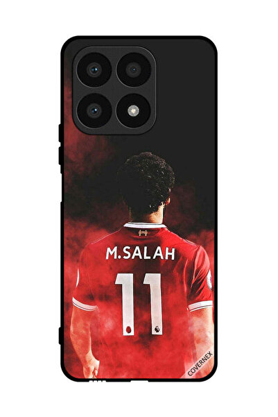 Covernex غطاء حماية لهاتف Honor X8a - نجمة مصرية