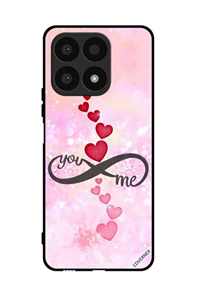 Covernex غطاء حماية لهاتف Honor X8a You And Me