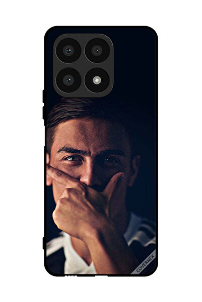 Covernex غطاء حماية لهاتف Honor X8a باولو دي جي