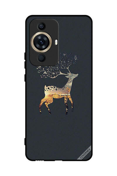 Covernex غطاء حماية لهاتف هواوي نوفا 11 - غزال