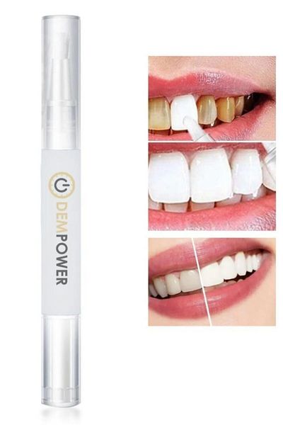 CMT ✨ Blue Light Technology Teeth Whitening Set