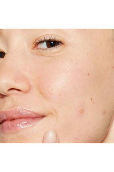 Dermalogica , Deep Acne Liquid Patch, Sulfur, Anti-Acnee, Local Treatment Lotion, For Acne ...