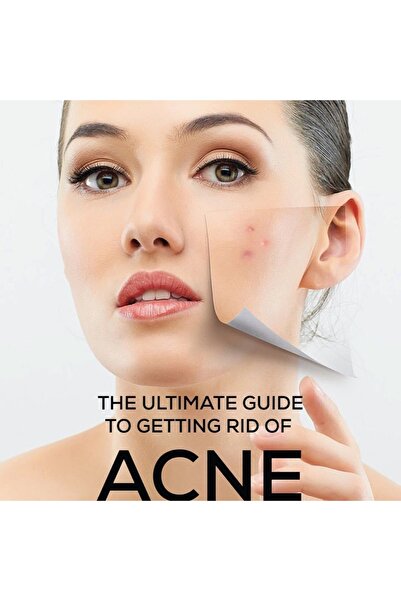 ACM Sebionex Purifying Bar 100g –soap-free Daily Cleanser For Oily & Acne-prone Skin, Gentle & Effective