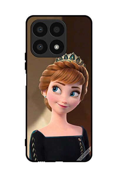 Covernex غطاء حماية لهاتف Honor X8a Frozen Anna