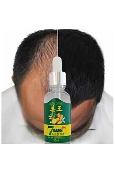 Enseb 7Days 7 Days 30ml Gingergerminalessentialoil Hair Growth Loss Treatment Serum Unisex 2 Pieces Hair Care