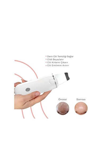 Bestech Ultrasonik Spatula Yüz Akne Giderici Siyah Nokta Temizleme Cihazı