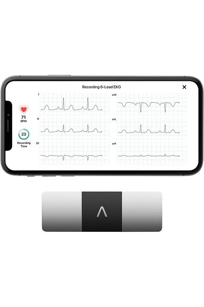 AliveCor ® KardiaMobile 6L | Wireless 6-Lead ECG | Works with Smartphone | Detects AFib or Normal He