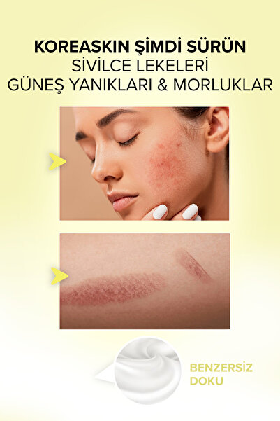 Acabella Koreaskin Cilt Beyazlatıcı , Aydınlatıcı Leke Karşıtı Bakım Kremi
