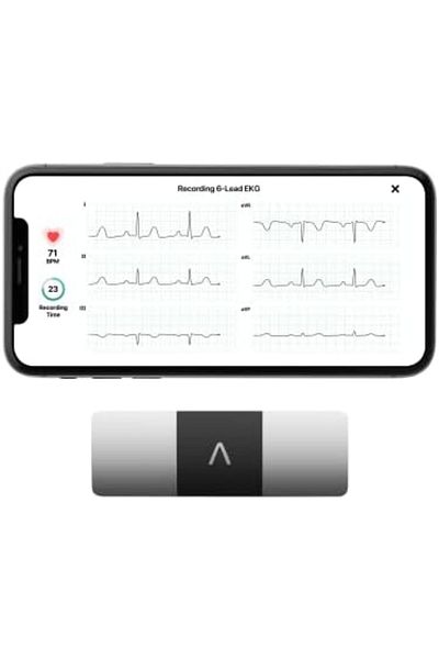 AliveCor ® KardiaMobile 6L | Wireless 6-Lead ECG | Works with Smartphone | Detects AFib or Normal He