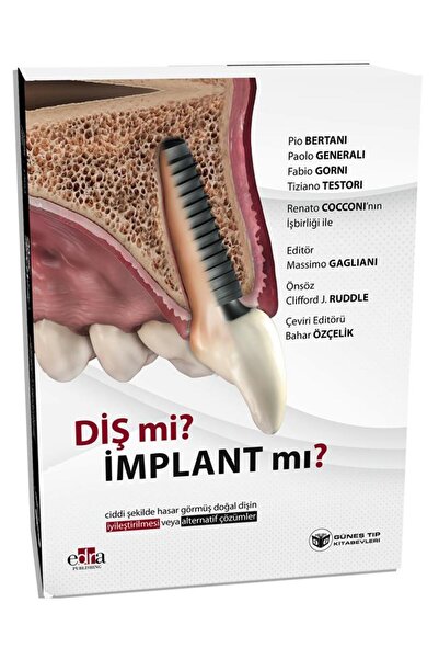 Güneş Tıp Kitabevleri Diş mi? İmplant mı? (Doğal Dişin Korunması veya İmplant Çözümleri Üzerine Kapsamlı Rehber)