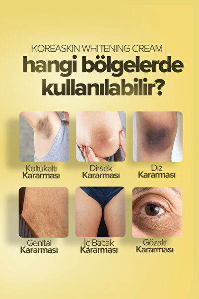 Acabella Koreaskin Cilt Beyazlatıcı , Aydınlatıcı Leke Karşıtı Bakım Kremi