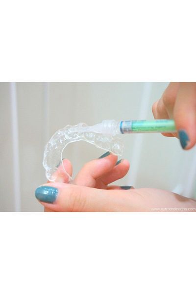 Opalescence Kit de albire a dinților, Opalescence, PF Mint, 2 seringi x 1,2 ml, peroxid de carbamidă 10%, matrițe