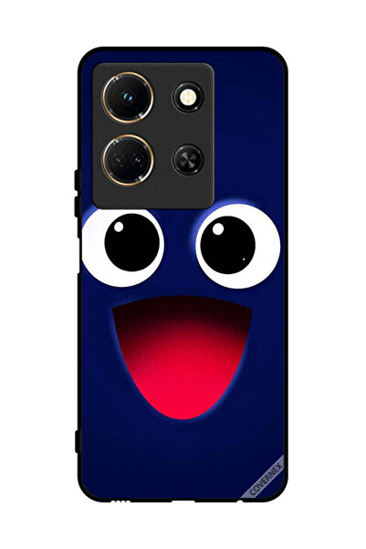 Covernex غطاء حماية لجهاز Infinix Note 30 بابتسامة سعيدة