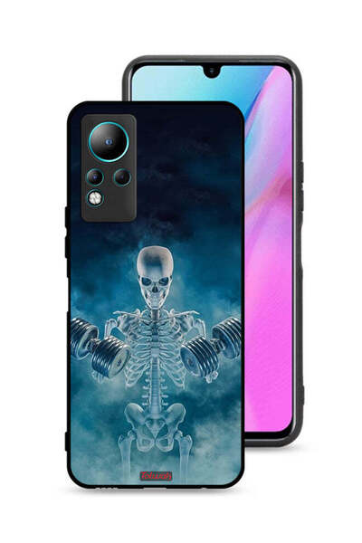 Tolwak غطاء حماية انفينيكس نوت 11 - وضعية عدم الألم وعدم الربح