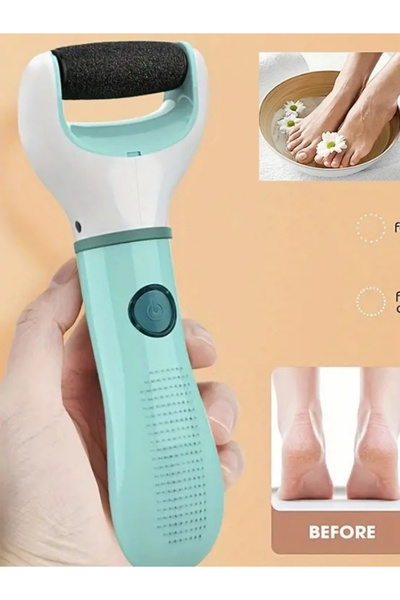 NaturalCharm Taşınabilir Elektrikli Ayak Topuk Törpüsü USB Şarjlı, Nasır ve Çatlak Temizleyici
