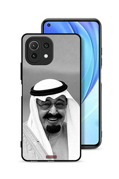 Tolwak غطاء حماية لهاتف شاومي مي 11 لايت صورة الملك عبدالله مبتسماً